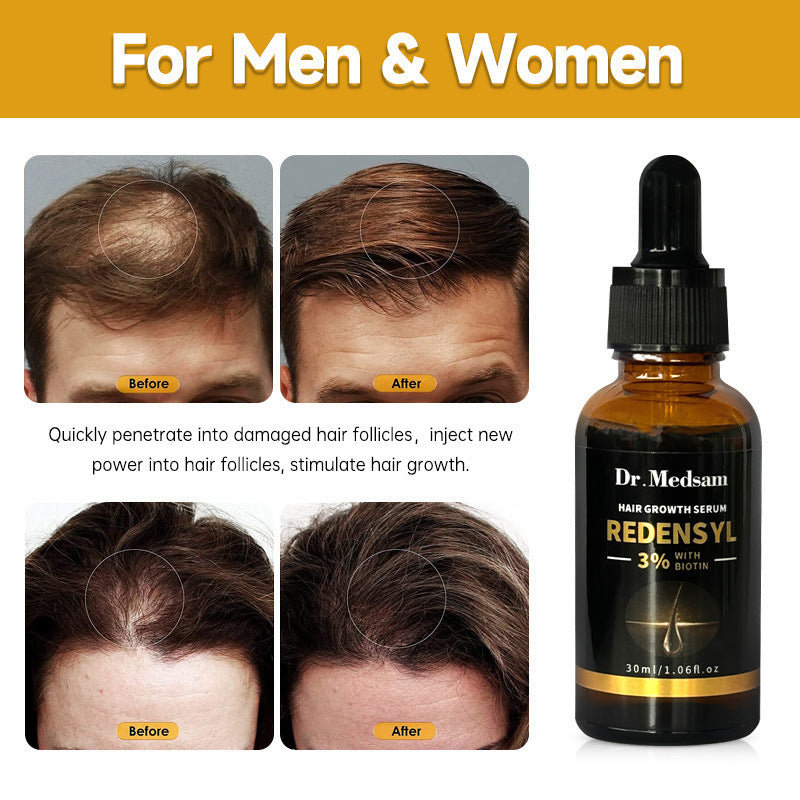 Esencia Capilar de Biotina y Romero – Cabello Más Fuerte y Abundante