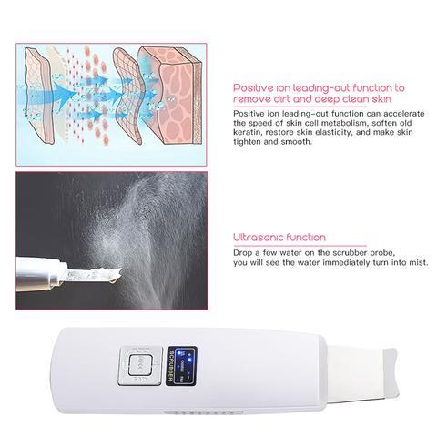 Limpiador Facial Ultrasónico – Piel Radiante y Libre de Imperfecciones
