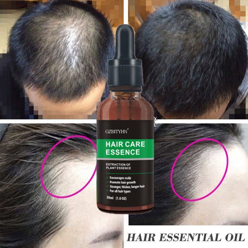 Aceite para el Crecimiento del Cabello – Nutrición y Fortalecimiento