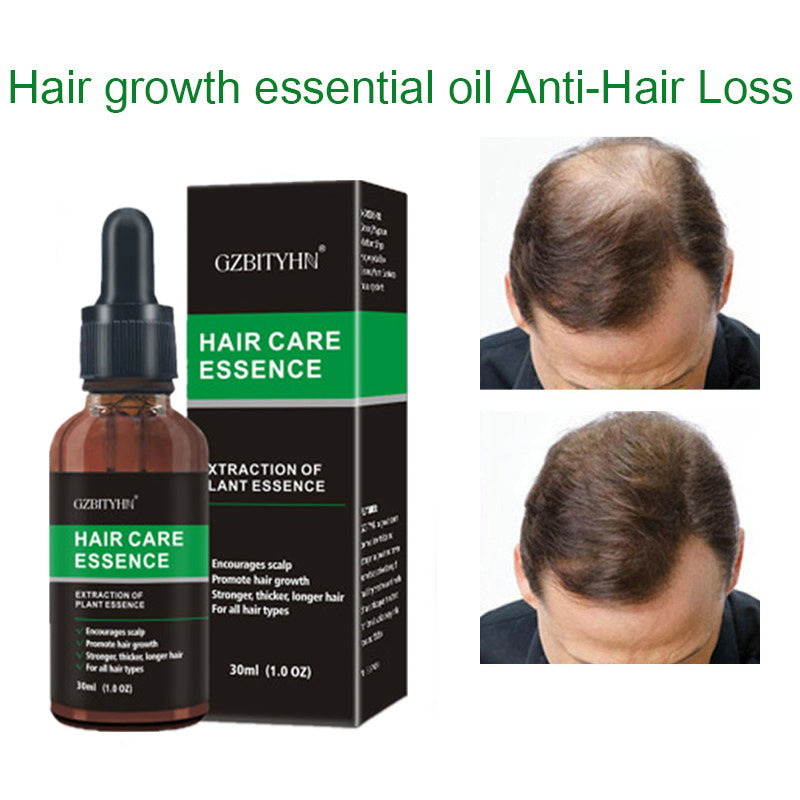 Aceite para el Crecimiento del Cabello – Nutrición y Fortalecimiento