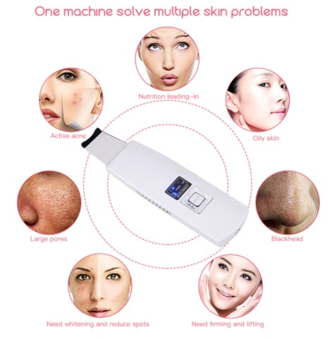 Limpiador Facial Ultrasónico – Piel Radiante y Libre de Imperfecciones