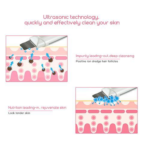 Limpiador Facial Ultrasónico – Piel Radiante y Libre de Imperfecciones