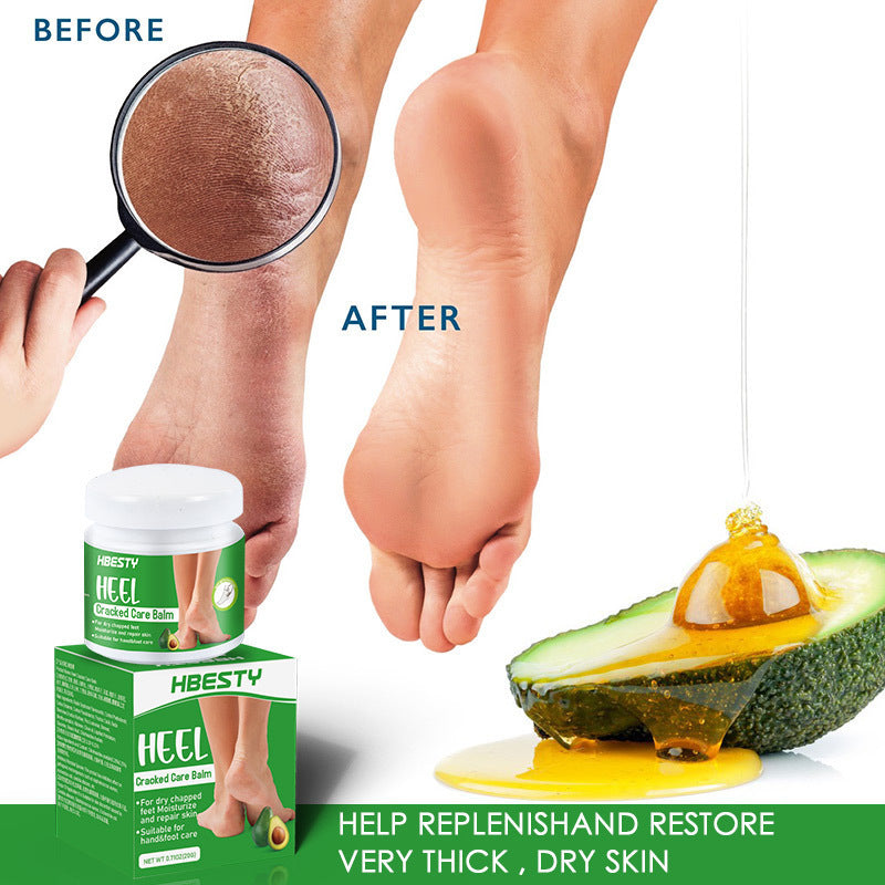 Crema de Aguacate – Reparación Intensiva para Talones Agrietados