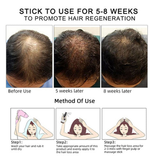 Aceite para el Crecimiento del Cabello – Nutrición y Fortalecimiento