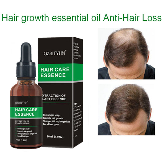 Aceite para el Crecimiento del Cabello – Nutrición y Fortalecimiento