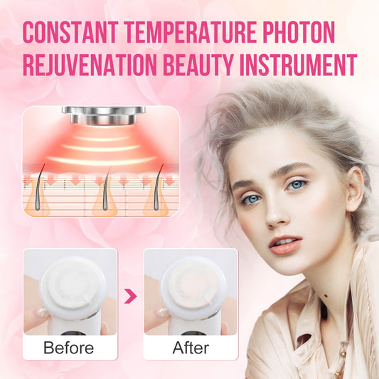 Dispositivo de Rejuvenecimiento Facial IPL – Lifting y Luminosidad en Casa
