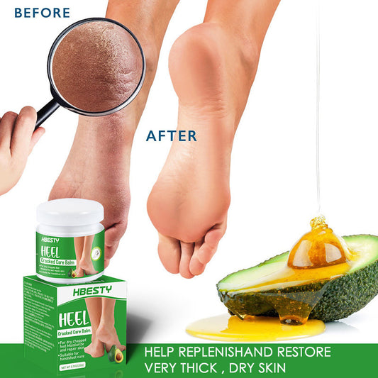 Crema de Aguacate – Reparación Intensiva para Talones Agrietados
